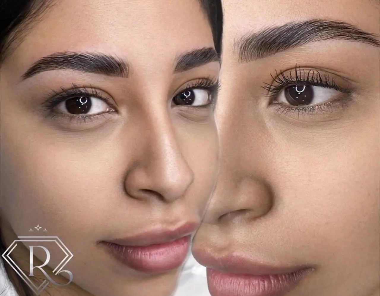 Antes y después de una micropigmentación de cejas: la mitad izquierda del rostro sin tratar y la derecha ya tratada